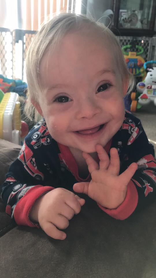 down syndrome gerber baby